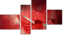 Erőd